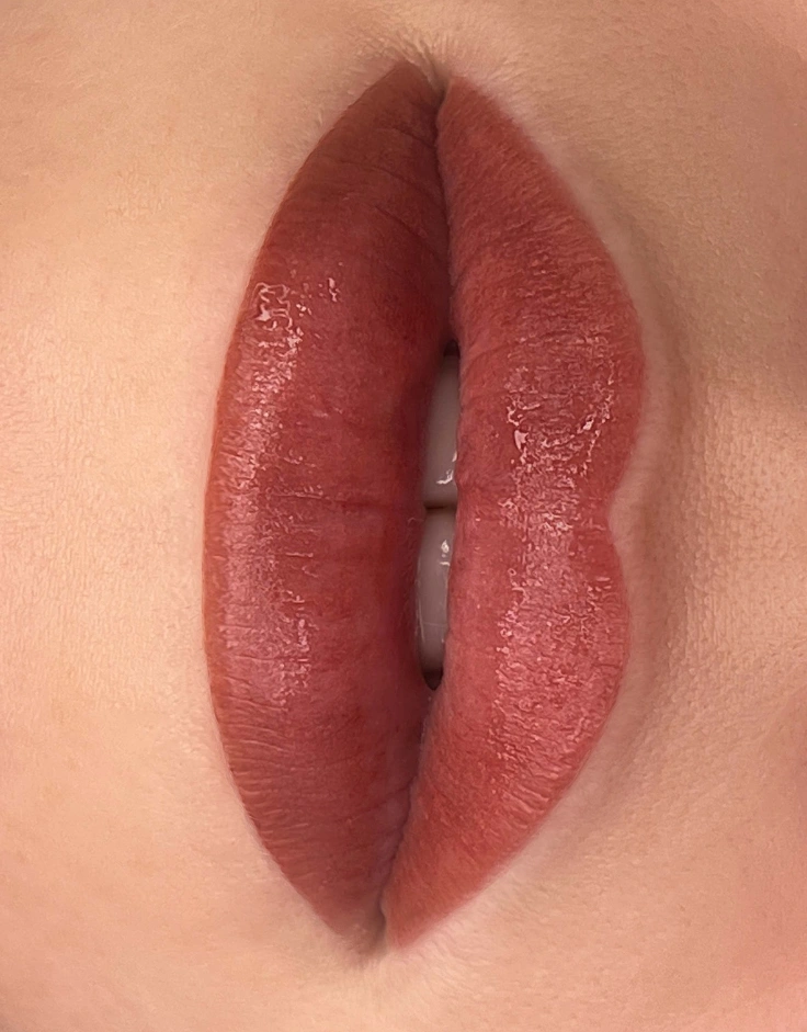 68 (5)