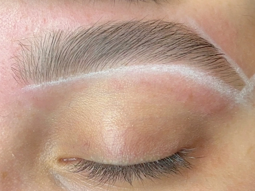 7 (20)