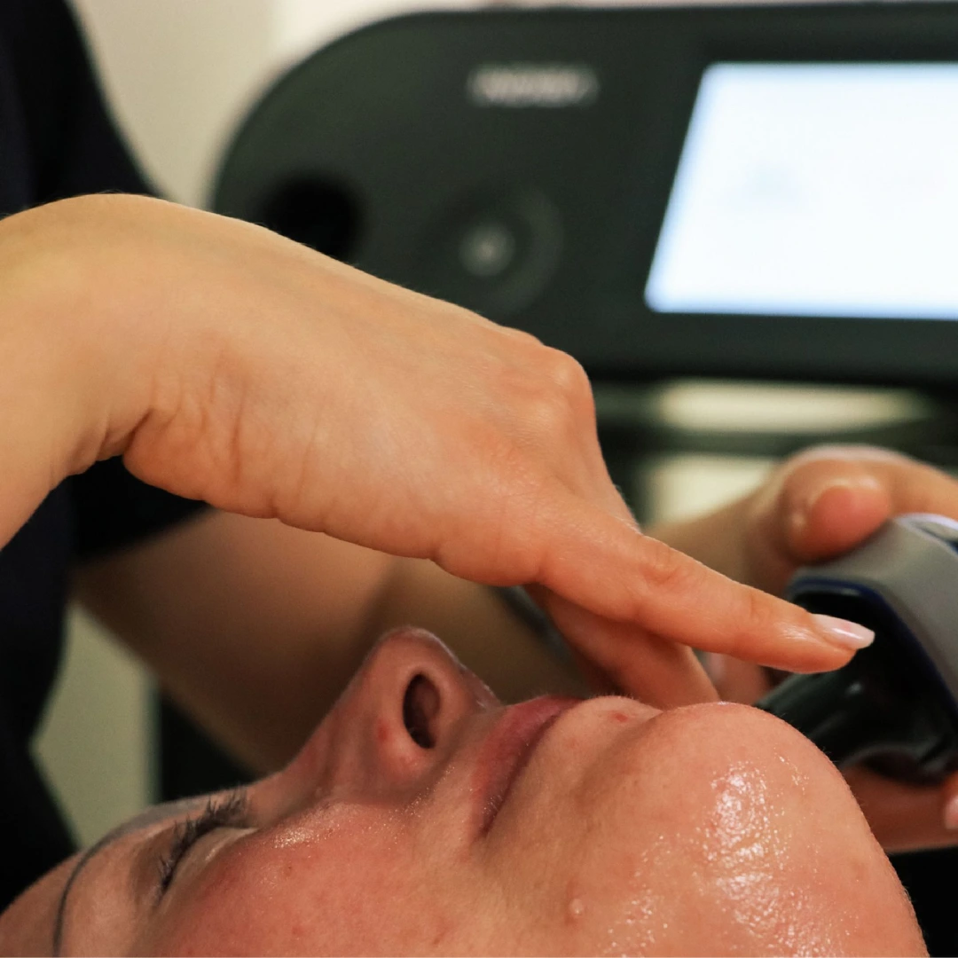 INDIBA FACIAL