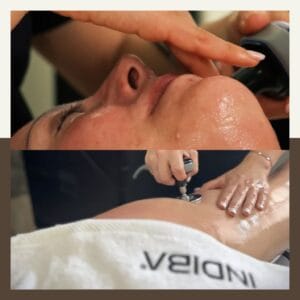 INDIBA Facial - Corporal